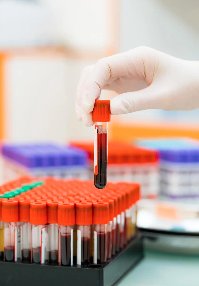 Online Lab Test Booking In Jodhpur